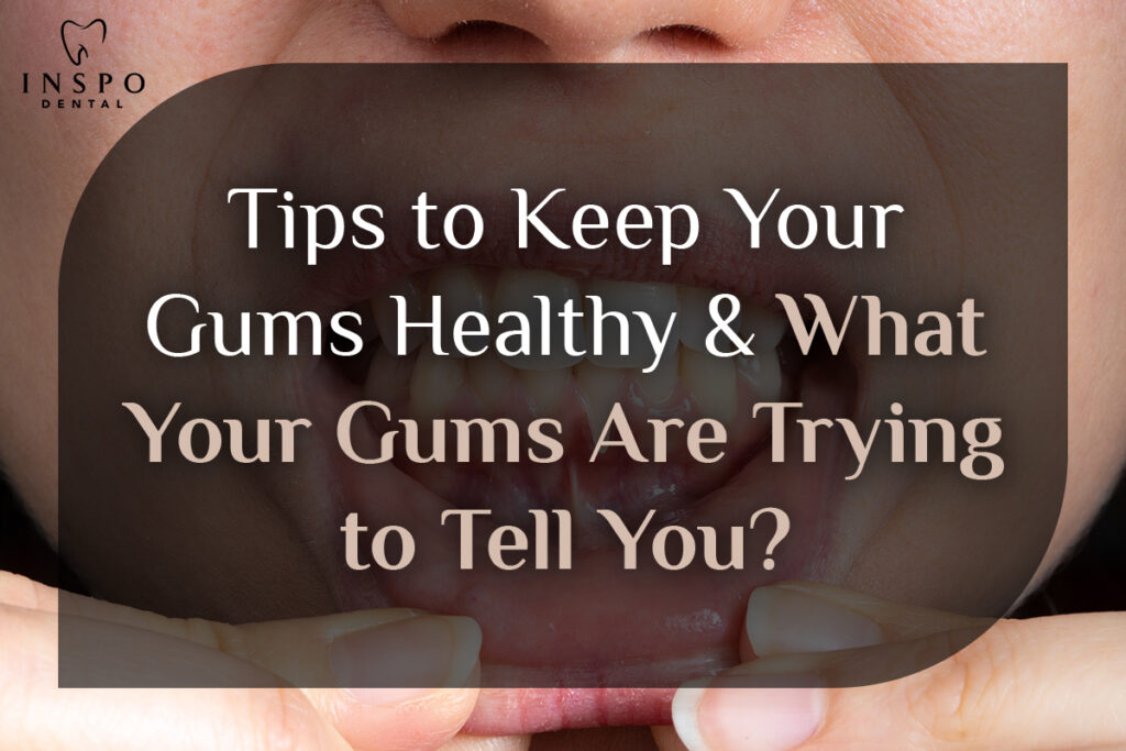 Tips-to-Keep-Your-Gums-Healthy-&-What-Your-Gums-Are-Trying-to-Tell-You-Featured-16-Dec-2024