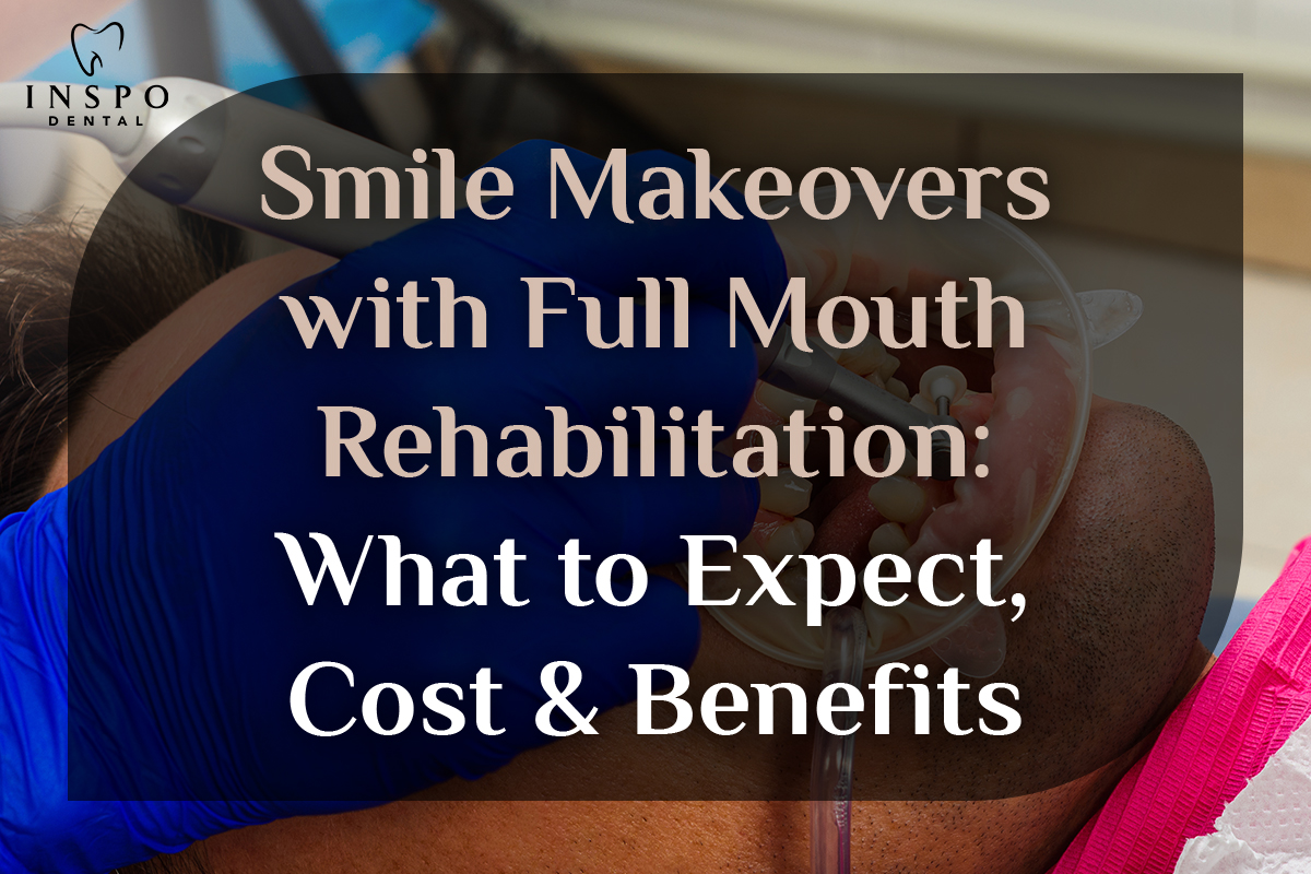 Smile-Makeovers-with-Full-Mouth-Rehabilitation-What-to-Expect,-Cost-&-Benefits